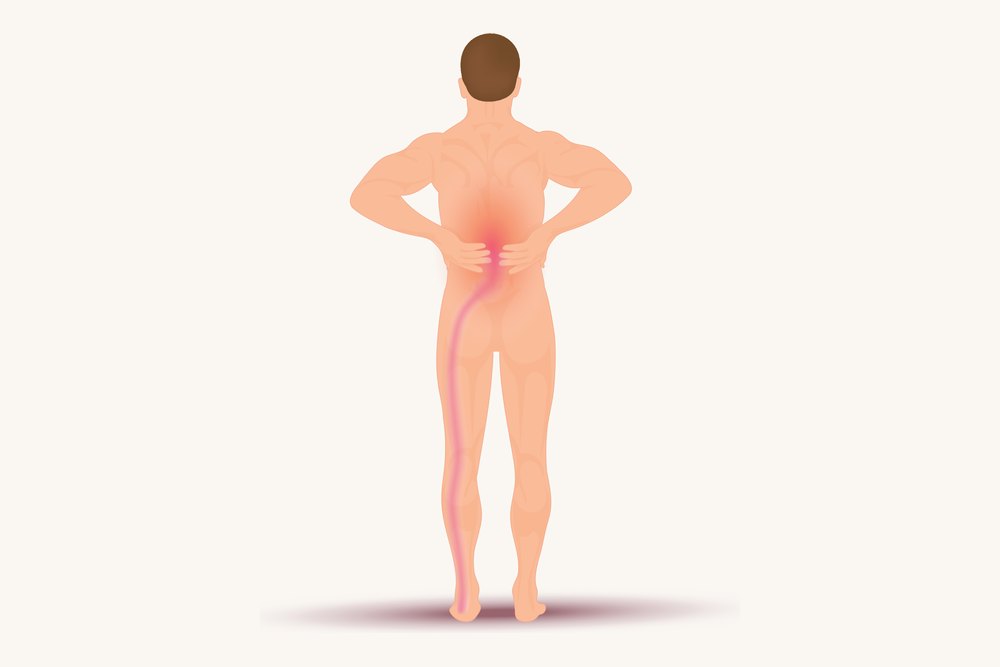 A figure from behind showing pain running from the lower back down one leg